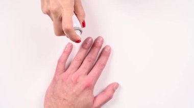 Parmağında ikinci derece yanıklar var. Yüksek kaliteli video