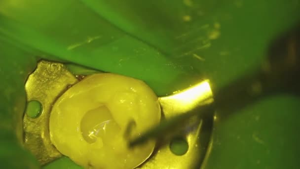 Odontologia Fotografia Microscópica Tratamento Dentário Instalação Recheio Fotopolímero Com Uma — Vídeo de Stock