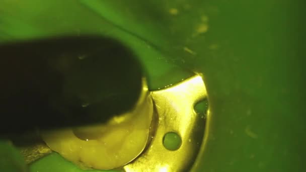 Odontología Disparando Con Microscopio Tratamiento Dental Utilizando Una Lámpara Fotopolímero — Vídeos de Stock