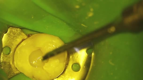 Stomatologii Mikroskopijna Fotografia Leczenie Stomatologiczne Montaż Wypełniacza Fotopolimerowego Kielnią Korkociągiem — Wideo stockowe