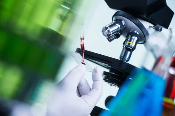 Laboratorní vědec drží snímek obsahující krevní vzorek w — Stock fotografie
