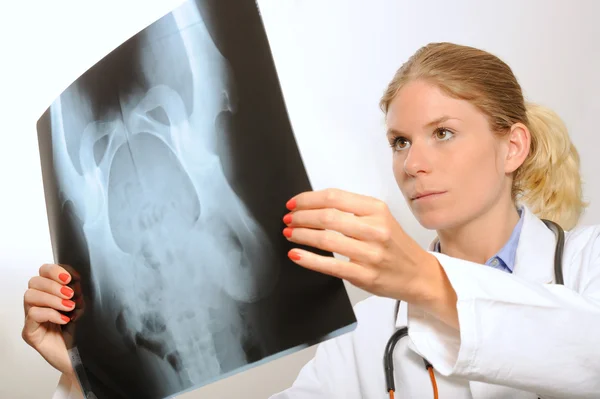 Vrouwelijke arts behandeling een x-ray afbeelding — Stockfoto