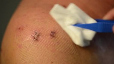 Hemşire hastanın bir omuz noktalarını kaldırma