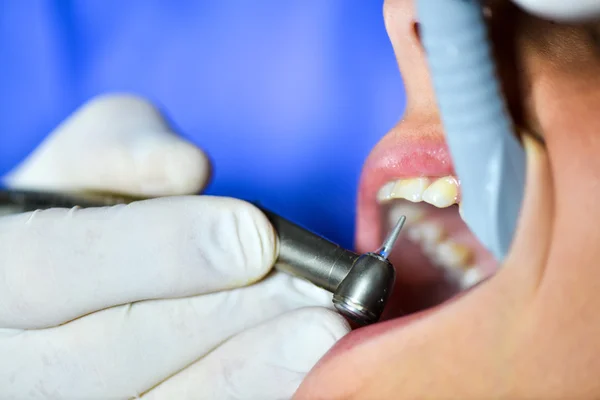 Frauen beim Zahnarzt — Stockfoto