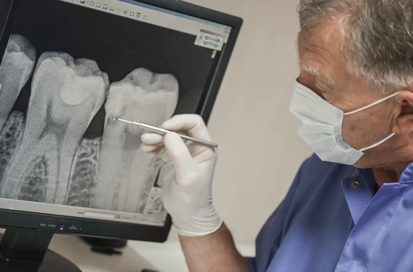 Zahnarzt sieht Röntgenbild auf Computerbildschirm. — Stockfoto