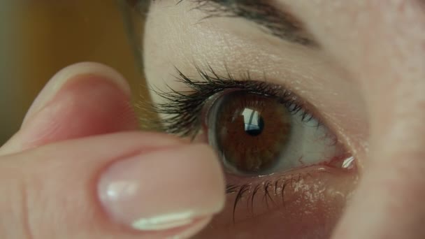 Kvinna med bruna ögon tar bort en kontaktlins på ögat med fingrarna, närbild — Stockvideo