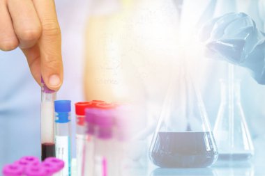 Hastanedeki laboratuvarda kan örnekleriyle el ele tutuşma tüpü..