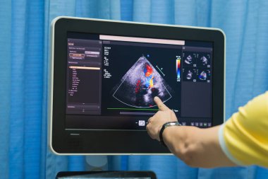 Doktorun karın bölgesinde ultrason çektirmesine yakın çekim..