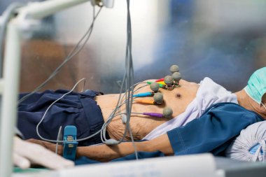 Elektrokardiyogram için elektrodları olan bir hastanın EKG 'si ya da EKG' si hastanede yatıyor.