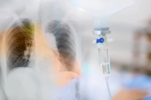 Tıbbi Koronavirüs Kovid Teşhisi Için Insan Ciğerlerinin Röntgeni Normal Tuz — Stok fotoğraf