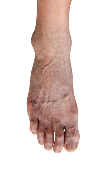 Foot of elderly woman isolate on white background — Stock Photo, Image