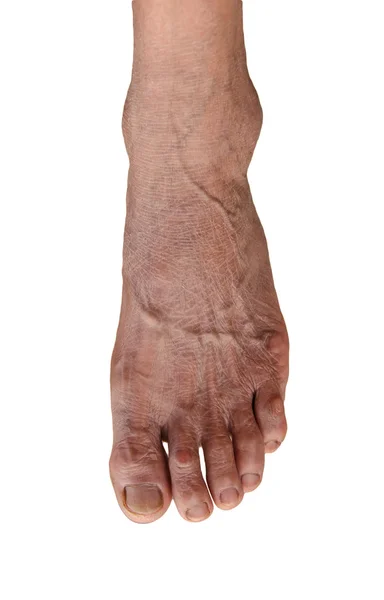 Fuß einer älteren Frau isoliert auf weißem Hintergrund — Stockfoto