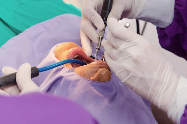 Der Arzt reinigt den Zahnpatienten mit Ultraschallgerät — Stockfoto