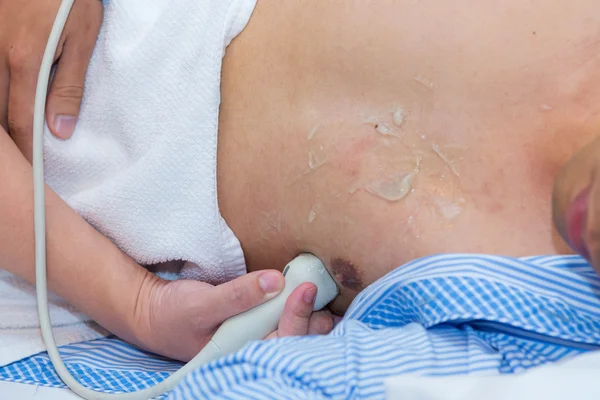 Detailní záběr muže na ultrazvukové vyšetření břicha lékařem — Stock fotografie