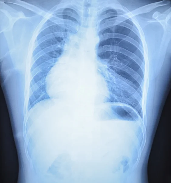 X-ray results in hospital — Stock Photo, Image