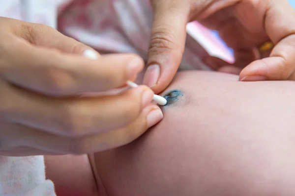 Rengöring umbilical i en nyfödd flicka — Stockfoto
