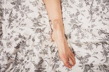 Yatakta yaralı bacak