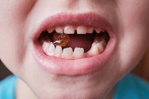 Boca grande de un niño sin diente. Primer diente caído. El hada de los dientes — Foto de Stock