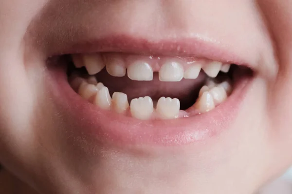 Boca grande de uma criança sem um dente. Primeiro dente caído. A fada dos dentes Fotografia De Stock
