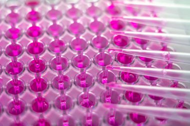 Tıbbi bir laboratuarda yakın plan numune almak.