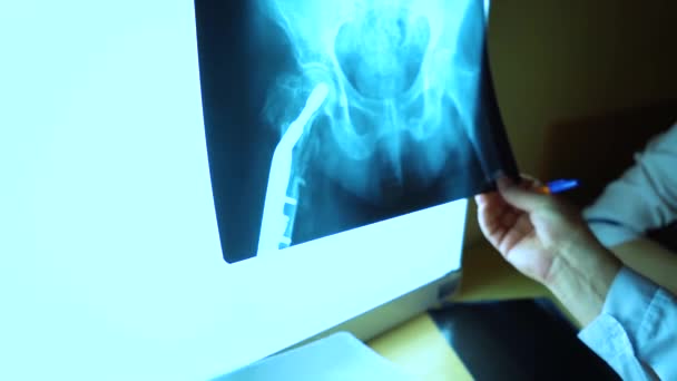 Les Travailleurs Médicaux Hôpital Examinent Les Empreintes Radiographiques — Video