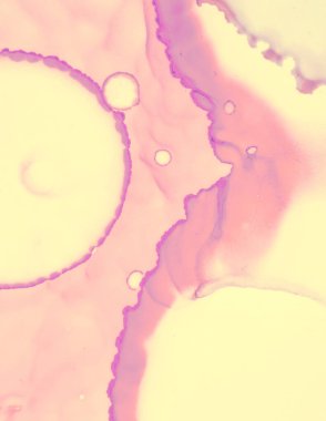 Düğün kartı tasarımı. Sarı Pastel Fış Fış.