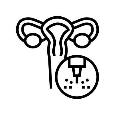 Rahimde tıbbi lazer tedavi çizgisi ikon vektör çizimi