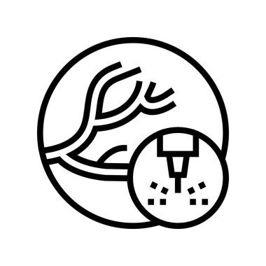 Vasküler patolojilerin kaldırılması çizgi vektör gösterimi