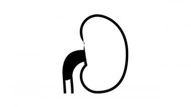 Böbrek taşı çizgisi canlandırması