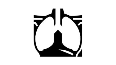 Akciğerler x-ray simge canlandırması