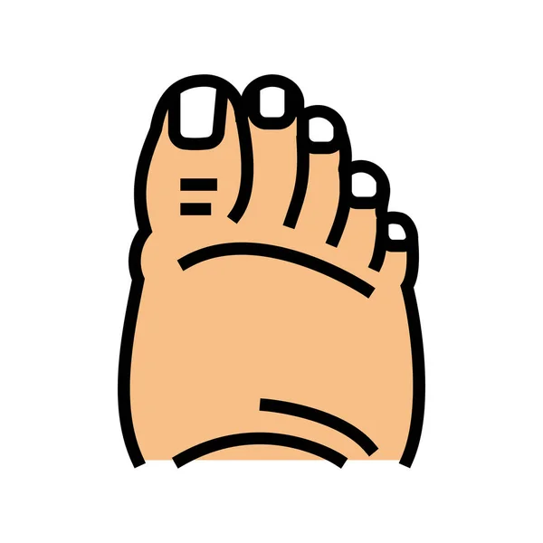 Fatty foot edema color icon vector illustration — Stock Vector