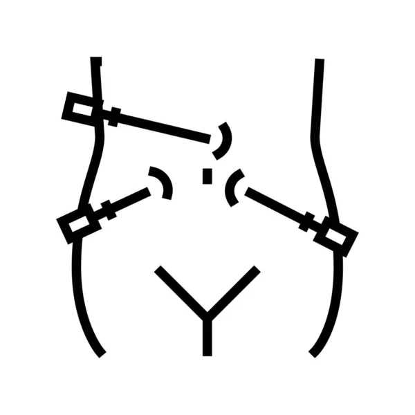 Laparoscopie bariatrische lijn pictogram vector illustratie — Stockvector