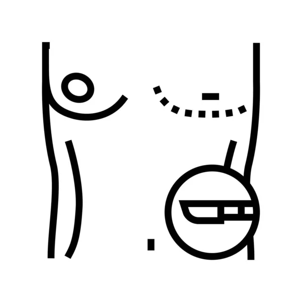 Ginecomastia mammaria linea icona vettoriale illustrazione — Vettoriale Stock