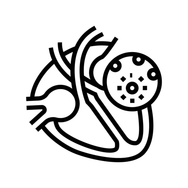 Myocarditis ziekte lijn pictogram vector illustratie — Stockvector