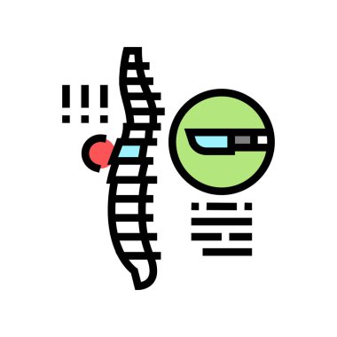 cerrahi skolyoz renk ikonu vektör çizimi