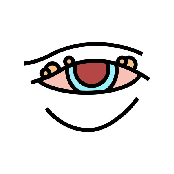 Blepharitis, Rötung des Augapfels Farb-Icon-Vektorillustration — Stockvektor