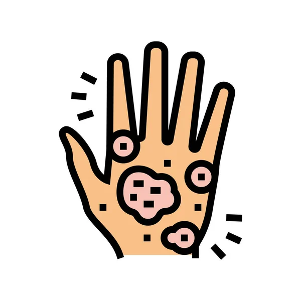Mão eczema cor ícone vetor ilustração — Vetor de Stock