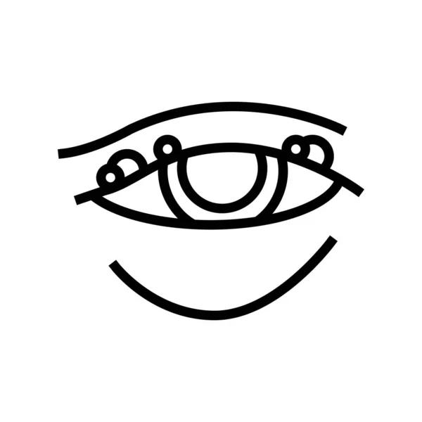 Хвороба блефариту, почервоніння значка лінії очного яблука Векторні ілюстрації — стоковий вектор