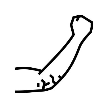 dirsek kuru cilt çizgisi vektör çizimi