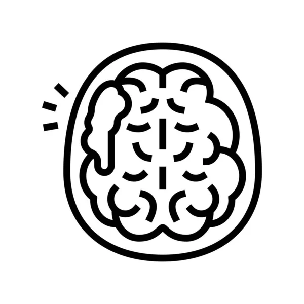 Ictus cerebral línea icono vector ilustración — Vector de stock