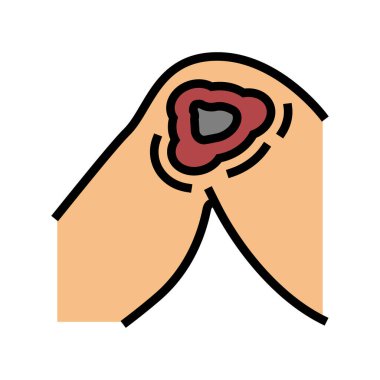 Cutaneous mucormycosis renk vektör çizimi