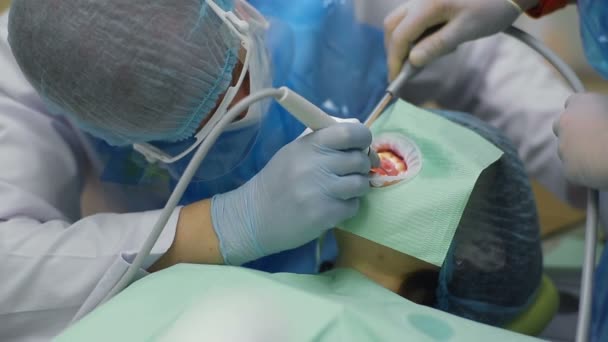 Tandarts werkt tanden van vrouw patiënt met speciale apparatuur — Stockvideo