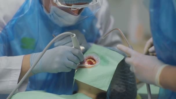 Стоматолог оперирует зубы пациентки со специальным оборудованием — стоковое видео