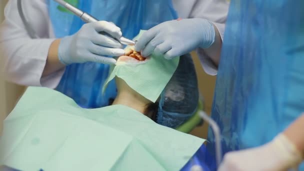Οδοντίατρος καθαρίζει τα δόντια του ασθενούς γυναίκα με ειδικό εξοπλισμό — Αρχείο Βίντεο