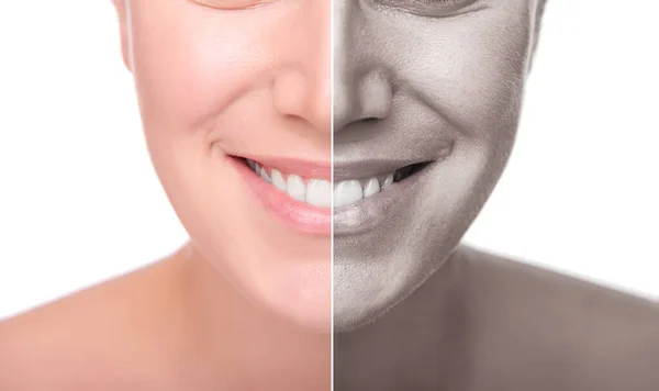 Un volto femminile è diviso a metà per la pelle buona e cattiva. Isolato su sfondo bianco — Foto Stock