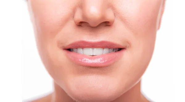 Wajah wanita dengan gigi putih terisolasi pada latar belakang putih — Stok Foto