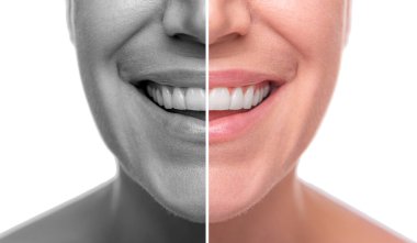 Bir kadının yüzü iyi ve kötü ten için ikiye ayrılır. Beyaz arkaplanda izole