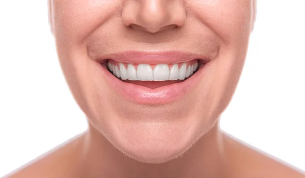 Cara femenina con dientes blancos aislados sobre fondo blanco —  Fotos de Stock