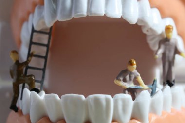 Minyatür insanlar ya da sağlık sigortası konsepti olarak diş temizleyen küçük figürlü işçiler. Temizlik ekibi diş veya diş hekimi fikri üzerinde çalışıyor.