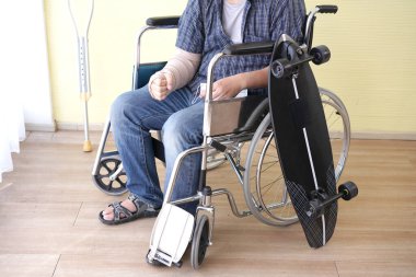 Kırık kemik ve sabitlenmiş yaralı bir adam. Sörf tahtası yüzünden alçıda kollar, aşırı kaykay kazası. Hastanede kolu kırık bir adam var..